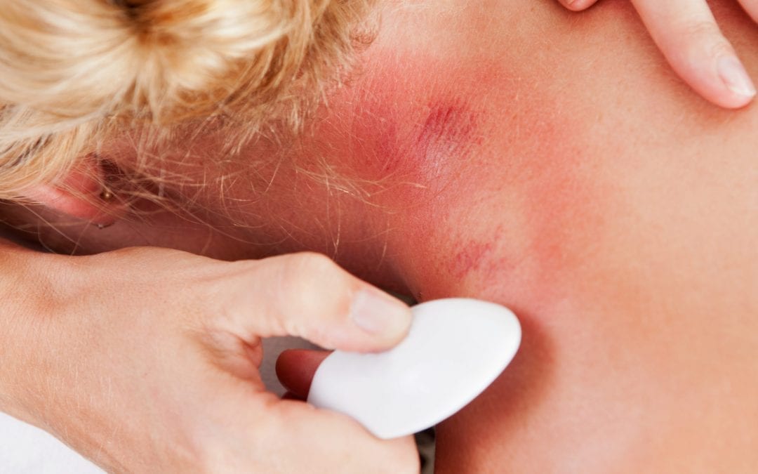 Looks bad but feels so good: the benefits of Gua Sha massage