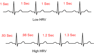 ECG Graph