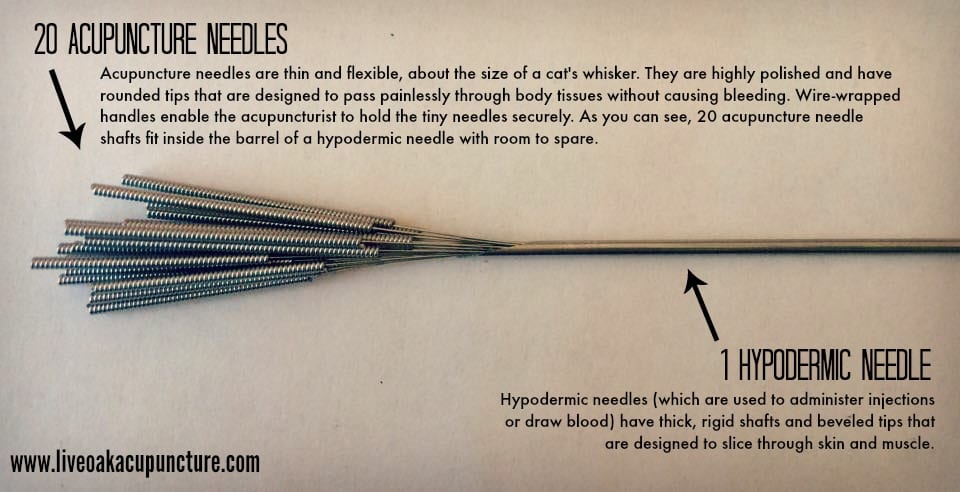 Photo of Acupuncture needles