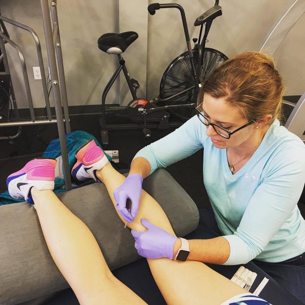 Dry Needling Being Performed
